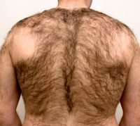 Back Hair